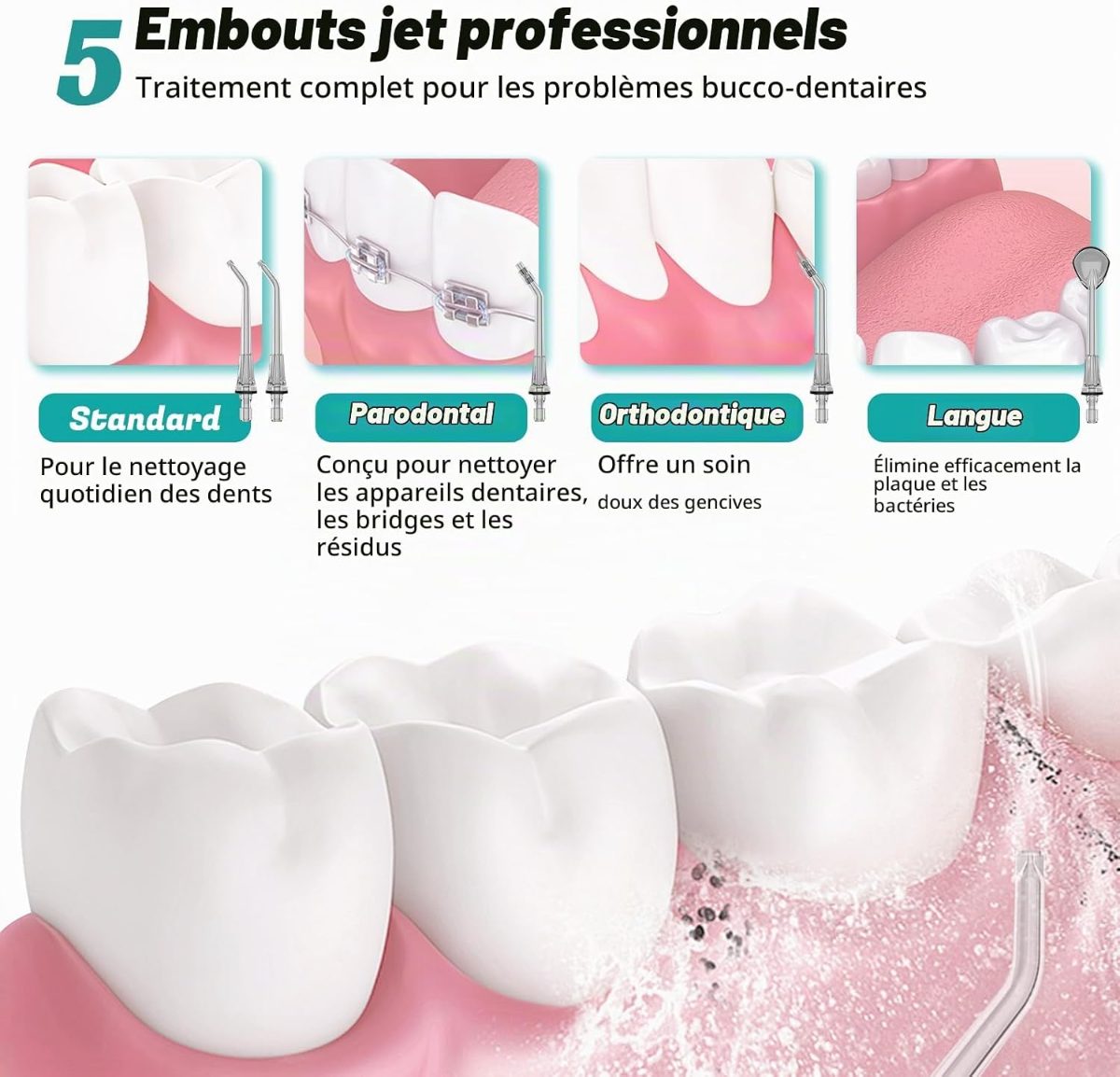 Les quatre types de buses livrées avec le FlossJet, illustrées en situation : standard, parodontale, orthodontique et gratte-langue